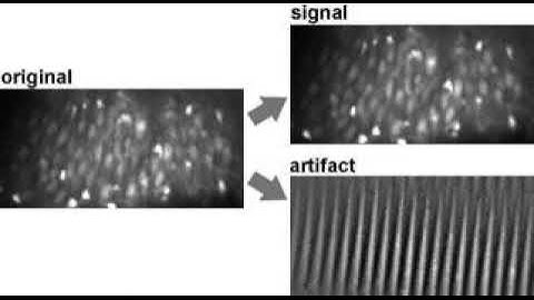High-Speed Multineuron Calcium Imaging Using Nipkow-Type Confocal Microscopy