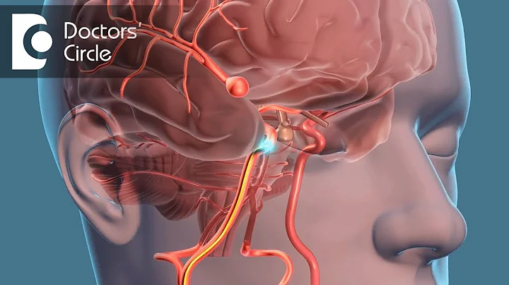 What is the recovery time for Brain Aneurysm? - Dr. Tejus MN Rao - DayDayNews
