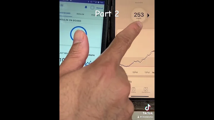 Replacing Omnipod5 with Dexcom G7