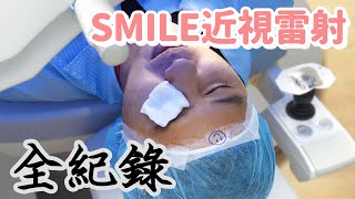 解除雙眼封印還我美美眼睛【SMILE全飛秒近視雷射體驗心得】什麼意思