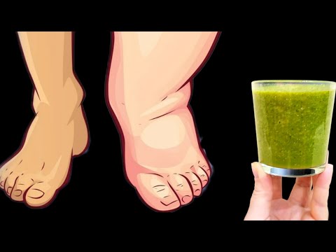 In nur 1 Woche wurde meine Mutter Ödeme und überschüssige Flüssigkeit im Körper los!