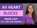Understanding Heart Blocks