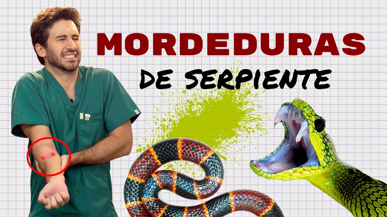 Mordeduras de serpiente | Doctor Negrete