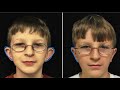 Detailed Analysis Of The Most Common Miscellaneous Facial Features!