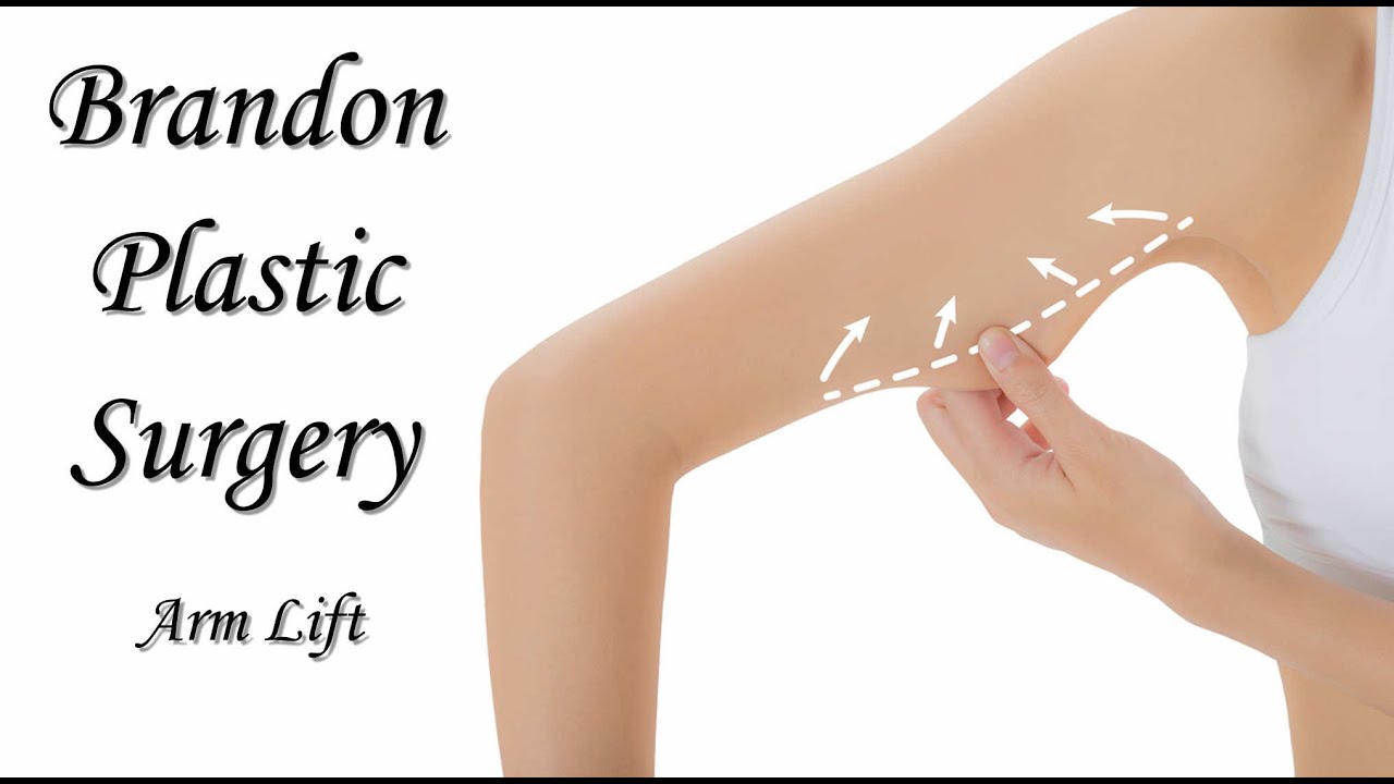 Tight and Sculpted Scarless Arm Lift YouTube