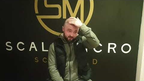 Scalp Micro Testimonial - Taylor - Scalp Micro Scotland