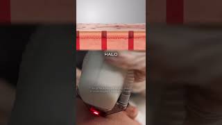 Halo — гибридный лазер для безупречной кожи #Halo #гибридныйлазер #пигментация #морщины