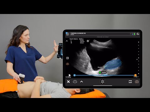 Image of Clarius Prostate AI