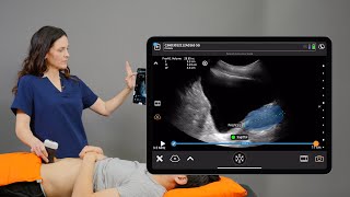 Clarius Prostate AI