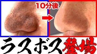 【いちご鼻】汚い黒ずみ本気で治します！毛穴の汚れを徹底除去します！