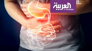 صباح العربية | كيف نعالج قرحة المعدة؟