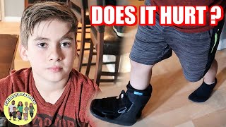 Broken Ankle Update | Is his BROKEN ANKLE getting better?