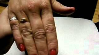 What is a Wrist-Assist