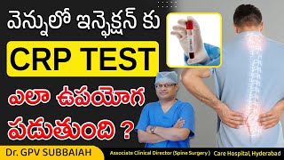 CRP test for spine | CRP test in telugu | CRP blood test in telugu | Health video | Dr GPV Subbaiah