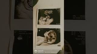 Друзья, Причина Отсутствия Новых Видео- Я Беременна 🥰🤰Уже 14 Неделя ❤