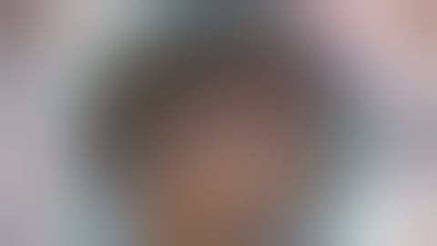 sublaxated lens with senile hard catarct + CTR + polishing of the posterior capsule