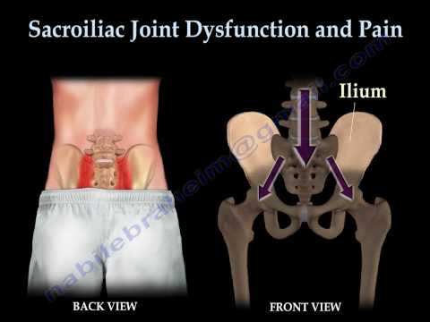Sacroiliac Joint Dysfunction Animation - Everything You Need To Know - Dr. Nabil Ebraheim, M.D.