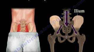 Video thumbnail of "Sacroiliac Joint Dysfunction Animation - Everything You Need To Know - Dr. Nabil Ebraheim, M.D."