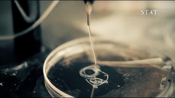 Printing blood vessels using “ink” made out of human cells and gel