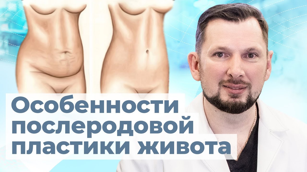 Послеродовая пластика живота | Абдоминопластика после родов: показания и особенности