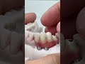 Dental Videos From around the World 13