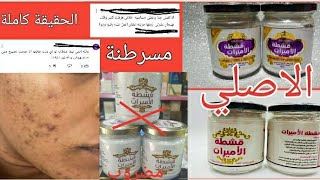 كل ما تريد معرفته عن قشطة الاميرات/هل فعلا خطير او لا؟/مهم جداااا