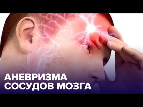 АНЕВРИЗМА сосудов мозга: чем ОПАСНА и как ее обнаружить