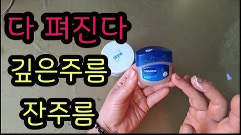 1000원으로 성형을 할수있을까? 미간주름 팔자주름 깊은주름개선