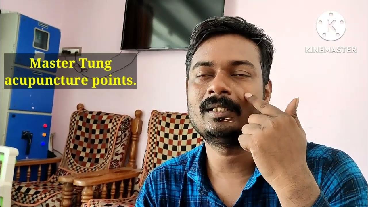 Master Tung acupuncture points for sciatica,back pain, kidney stones,and needling the points