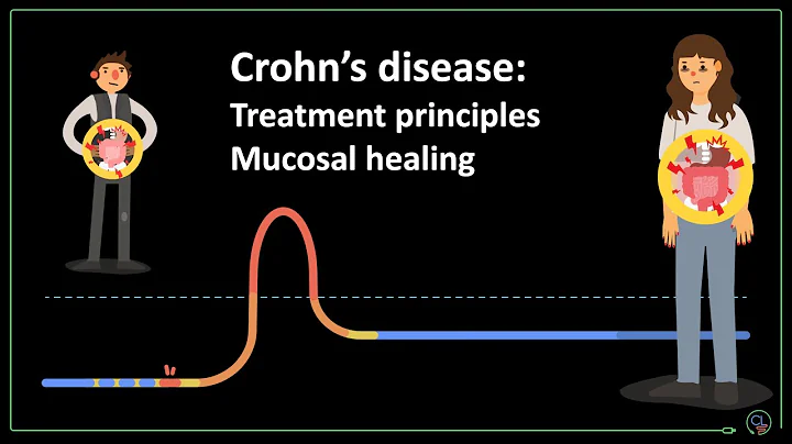 Crohn's disease: treatment principles and mucosal ...