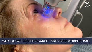 Powerful Skin Tightening with Radio Frequency Microneedling