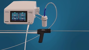 Swiss LithoClast® Trilogy Lithotripter