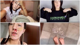 ♡ What It's REALLY Like to Live with Gastroparesis! * BLOOD & VOMIT Warning* | Amy Lee Fisher ♡