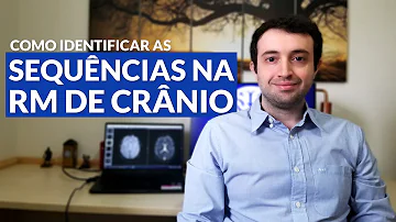 O que a ressonância do crânio pode detectar?