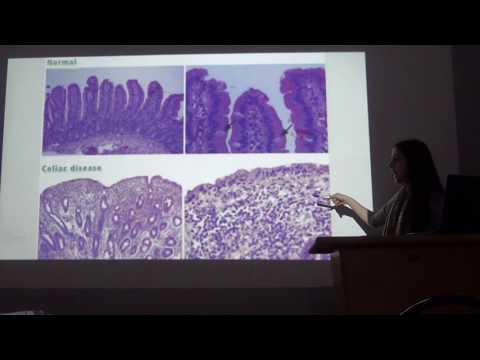 ცელიაკია - კლინიკური შემთხვევა, ნანუკა ციბაძე, 2016