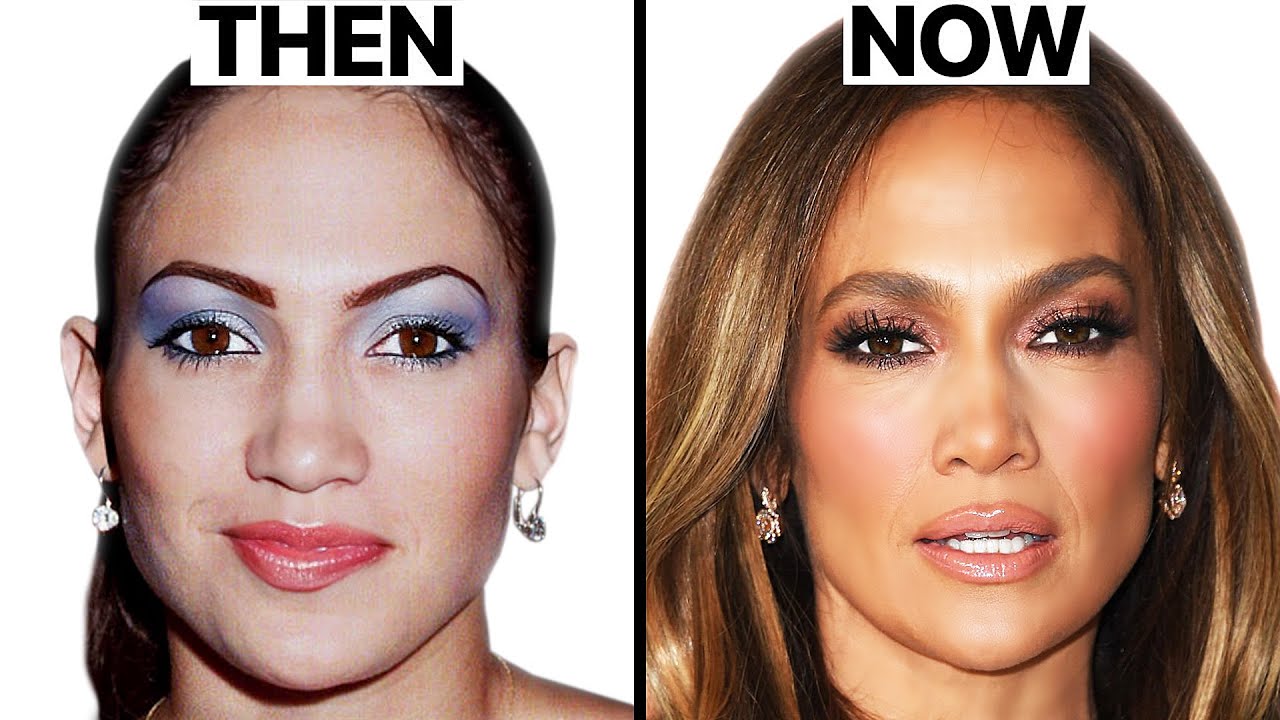 Jennifer Lopez New Face | Plastic Surgery Analysis - Youtube