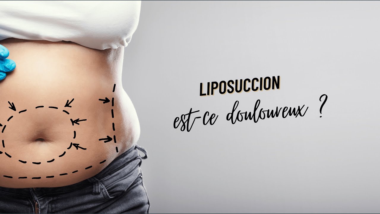 [LIPOSUCCION] Est-ce douloureux ?