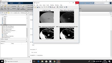 Matlab code for Automatic Detection of Retinal Lesions