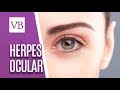 Herpes Ocular - Você Bonita (28/08/18)
