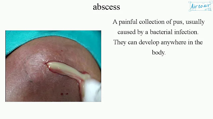 abscess (English) - Medical terminology for medical students - - DayDayNews