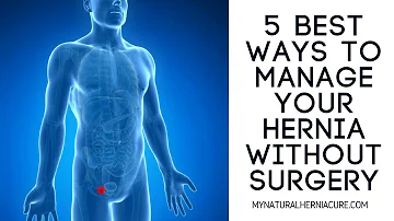 The Five Best Ways to Manage an Inguinal Hernia Without Surgery