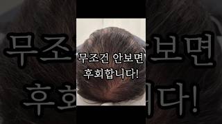언제까지 탈모 고민할꺼야? #두피문신 #정수리두피문신 #탈모치료 #천안두피문신 #아산두피문신 #정수리탈모 #탈모커버 #탈모문신 #가르마두피문신 #가르마탈모