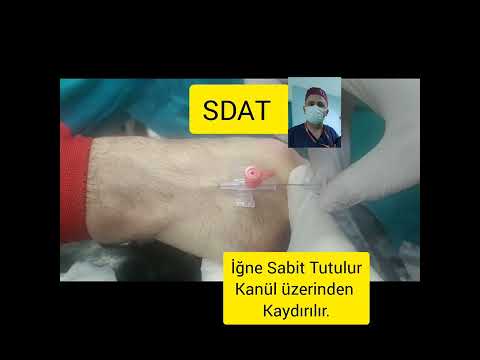 SDAT ile MUDAT