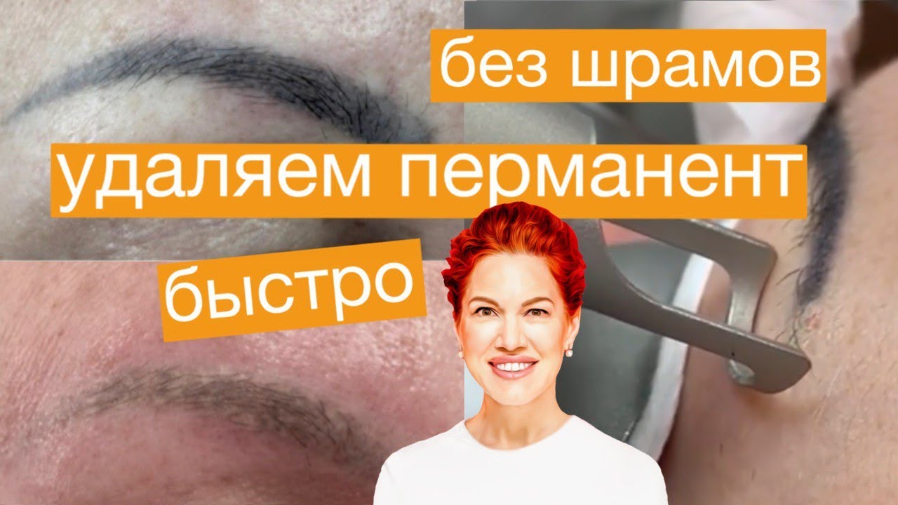 УДАЛЕНИЕ ПЕРМАНЕНТНОГО МАКИЯЖА - YouTube
