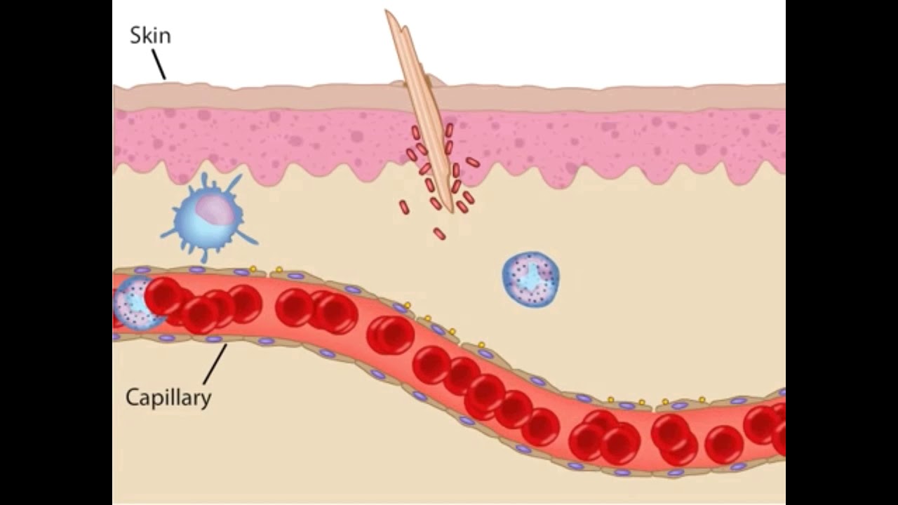 Воспаление картинки для презентации