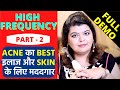 HIGH FREQUENCY FACIAL FULL DEMO - ACNE का BEST इलाज और SKIN के लिए मददगार - Part 2