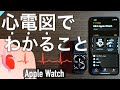 【Apple Watch】何ができるの?心電図機能を詳しく解説!