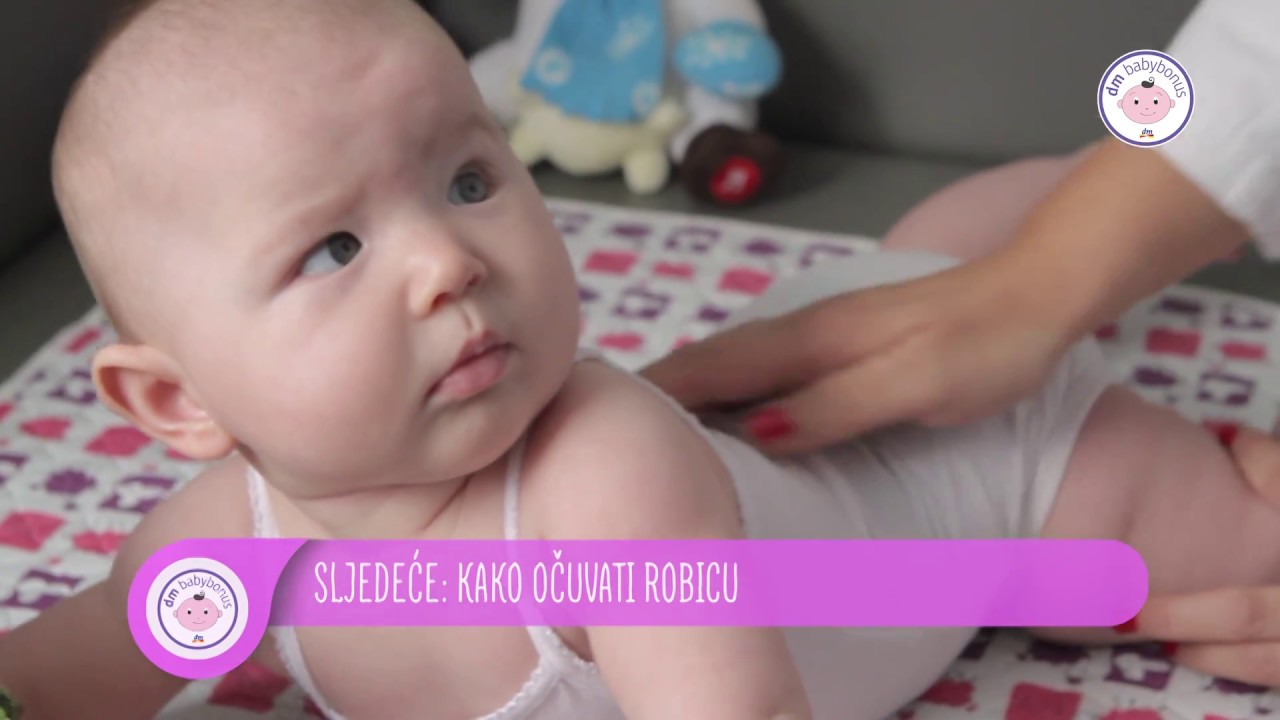 dm babybonus e31 - Žutica kod djece