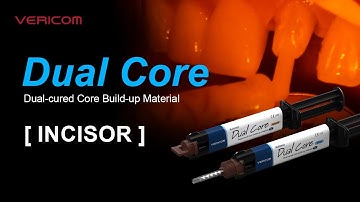 Dual Cured Core Build up Material Incisor
