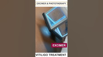 Phototherapy Excimer: The Future of Vitiligo Treatment | Care Well Medical Centre #shorts